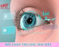 RỐI LOẠN THỊ GIÁC HAI MẮT